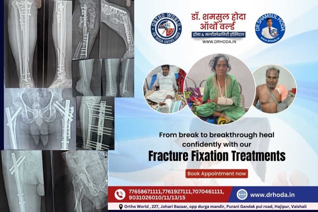 Complex Fracture - Advanced Orthopaedic Surgery Techniques